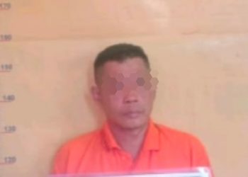 Ayah Tiri Bakar Anak Dibawah Umur Dengan Api Rokok, Polsek Palika Amankan M