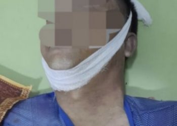 Insiden Polisi Tembak Polisi Terjadi Lagi