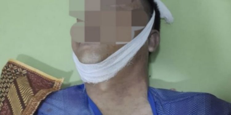 Insiden Polisi Tembak Polisi Terjadi Lagi