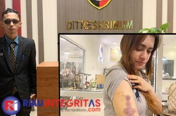 Sering Diancam dan Diteror, Kuasa Hukum Korban Penganiayaan Kirim Surat ke LPSK