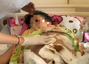 Viral, Diduga Terjadi Malpraktek di RS Bhayangkara Makassar, Humas RS Enggan Berikan Keterangan